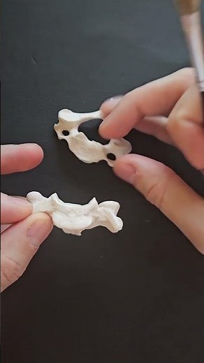 UNCINATE PROCESS, CERVICAL SPINE, #anatomy #spine #medstudents