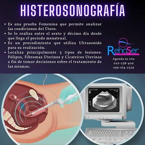La #histerosonografia es un estudio que se realiza para detectar lesiones uterinas que puedan generar varios problemas, incluso relacionados con #fertilidad femenina. Comentanos tus necesidades y permitenos ayudarte! Contáctanos 099-164-2329 / 022-238-787 #histerosonografiaquito #sonohisterografia #infertilidad #polipoendometrial #fibromauterino #fibroma #ecografia #ecografiaenquito #histerosalpingografia #fertilidadquito Gaby Trujillo Pazmiño | RehaSer - Ecografia Rayos X Traumatologia Fisioter