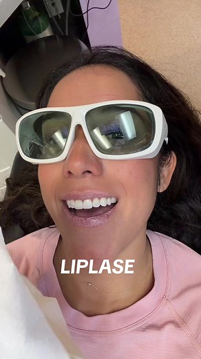 Enhancing My Lips with Laser Treatment