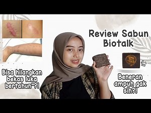 REVIEW JUJUR SABUN BIOTALK | PENGHILANG BEKAS LUKA AMPUH?!
