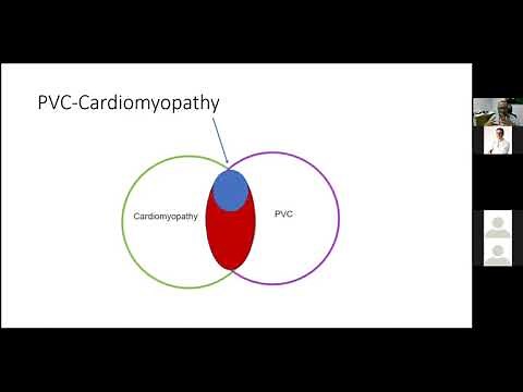 PVCs When Should We Worry
