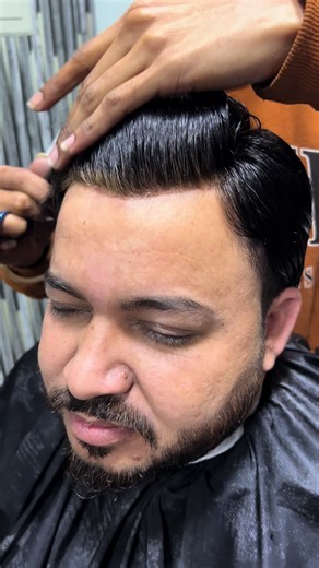 Hair Replacement Techniques at Capital Hair Club Faisalabad