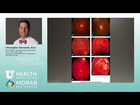 Diabetic Retinopathy