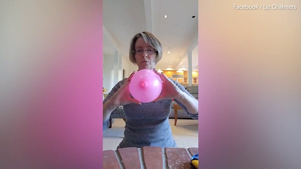 Balloon and ping pong ball show how cervix thins & dilates in labour