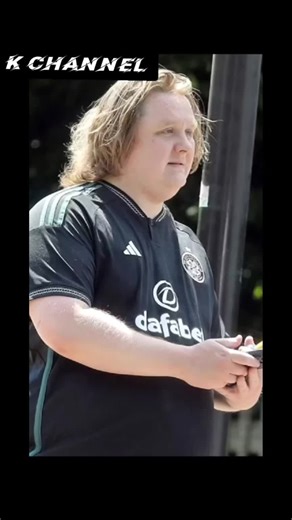 Lewis Capaldi: အာရုံကြောရောဂါနှင့် သီချင်းများ