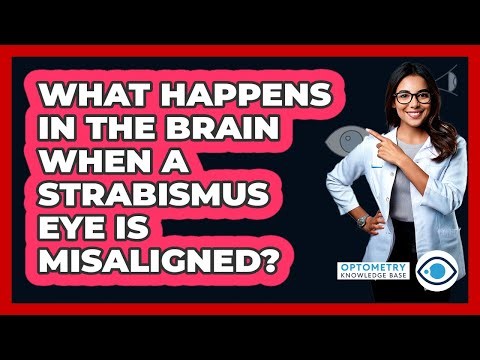 What Happens In The Brain When A Strabismus Eye Is Misaligned? - Optometry Knowledge Base