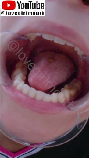 Girl with beautiful teeth with diamonds shows you her incisors, molars, tongue and palate #uvula