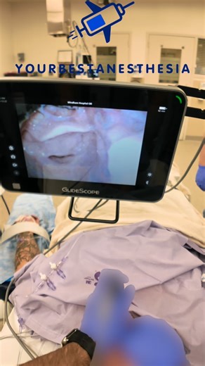 Naveed Tahir, MD on Instagram: "Always lift your glidescope blade after placing in in the mouth #yourbestanesthesia #anesthesia #anesthesiology #anesthesiologist #crna"