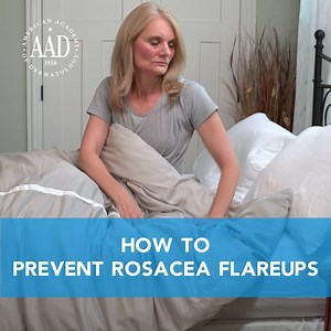 34K views · 91 reactions | Prevent rosacea flareups with these tips from board-certified dermatologists: https://bit.ly/2uNDTWa | American Academy of Dermatology | Facebook