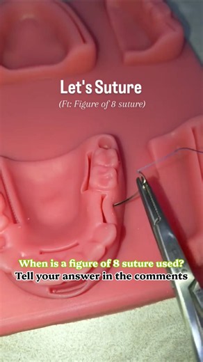 When is a figure of 8 suture is used? #bds #dentist #sutures #dentistry #pw #shorts #clinical