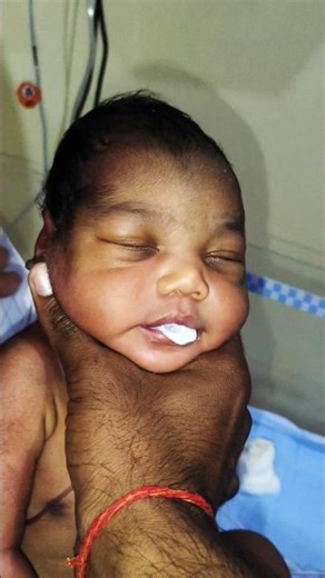 Newborn Baby Vomits After Milk Feeding 😢 | Heart-Touching Real Moment 🍼 #Shorts #BabyVomiting #Baby