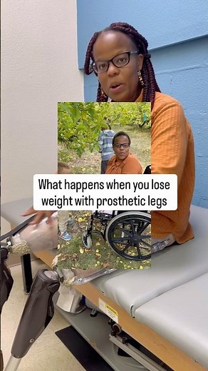 Prosthetic legs don’t grow or shrink with us.