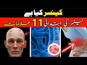 11 Early Warning Signs Of Cancer.