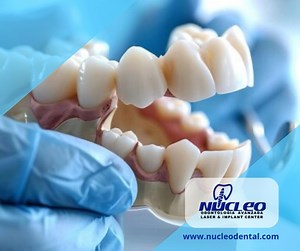 Stronger dental structure Full-mouth reconstruction can help preserve...