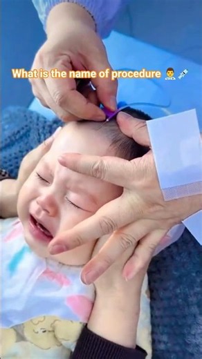 pediatrics#newborn#explore#viralreels#newbornbaby# #ehat is the name of procedure 👨‍⚕️ #followback