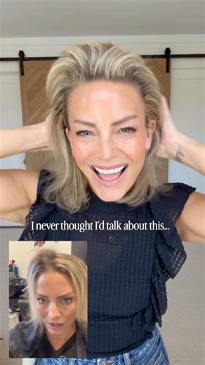 My hair loss story…