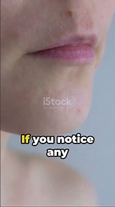 How to do a patch test for skincare products #skincaretips #skincareroutine ‪@TheSkinOdyssey-0911‬