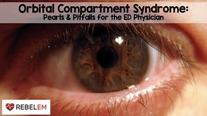 Orbital Compartment Syndrome: Pearls and Pitfalls for the ED Physician - REBEL EM - Emergency Medicine Blog