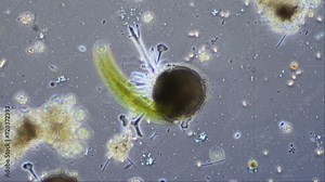 A testate amoeba, Diffulgia coronata, under the microscope at 200x magnification in phase contrast. This time lapse highlights its extending pseudopods, used to move, probe the environment and feed.