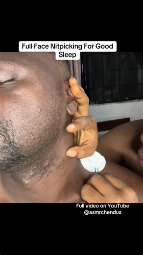 Full Face Nitpicking ASMR for Relaxation