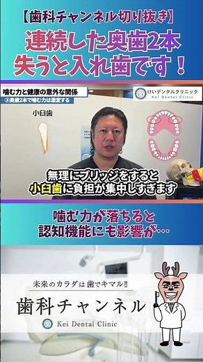 【歯科チャンネル切り抜き】噛めるって大事！奥歯2本ないと入れ歯です！