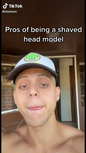The Advantages of Embracing Baldness in Modeling