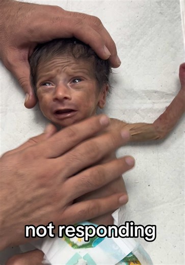 Pray for Our 27-Week-Old Baby Fighting for Life