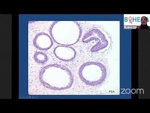 Meet the expert : Webinar 1 - Update on Breast Pathology and approach to diagnoses