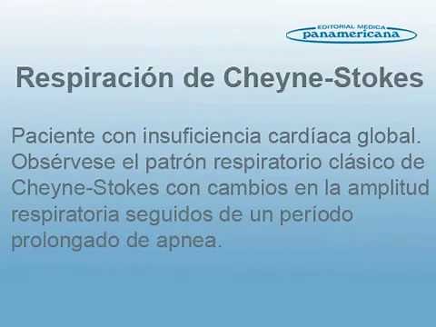 Video 38 Respiración de Cheyne Stokes