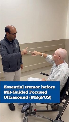 Essential Tremor Before/After Treatment With MR-Guided Focused Ultrasound (MRgFUS) - Froedtert & MCW