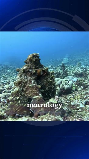 Octopus Arms MultiTasking Masters