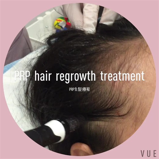 Aqua Laser Clinic on TikTok