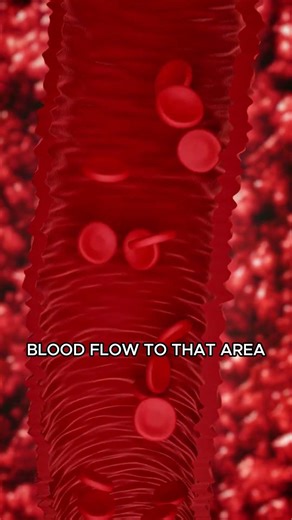 Pulse wave therapy works like this! #pulswavetherapy #menshealth #doctor