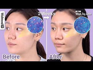 6 Tips on How To Take Care of Clogged Pores, Large Pores, Open Pores on Face | Wish, Try, Love