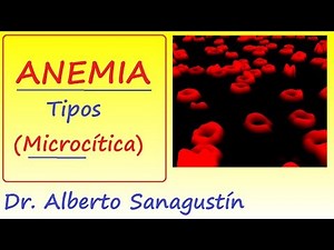 Anemias (1): síntomas y clasificación | Anemia Microcítica