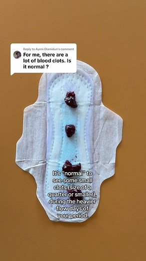 Understanding Blood Clots During Your Menstrual Period