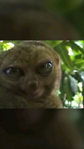 Crystal Medical Life|🏥| on Instagram: "The Tensilon test (edrophonium test) assesses muscle weakness due to myasthenia gravis, often reflected in symptoms like ptosis, or drooping of the upper eyelid. During the test, edrophonium chloride is injected intravenously to inhibit acetylcholinesterase, leading to increased acetylcholine levels at neuromuscular junctions. If a patient with ptosis has myasthenia gravis, the increase in acetylcholine can momentarily restore muscle function, causing the 