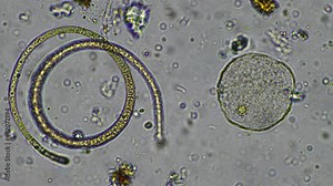 soil microorganisms under the microscope from a soil sample off a cow farm