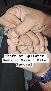 Thorn or Splinter Deep in Skin | Safe Removal