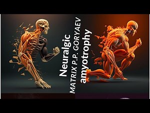 Neuralgic amyotrophy.