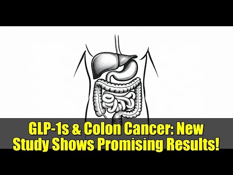 GLP-1s & Colon Cancer: New Study Shows Promising Results!