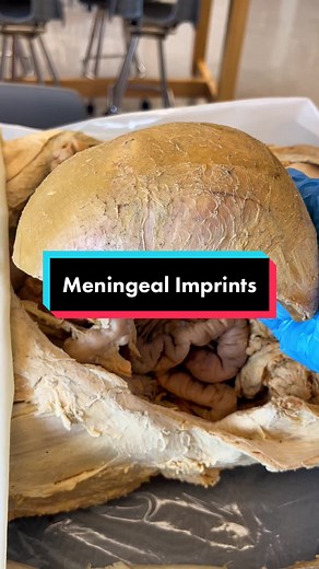 Exploring the Fascinating World of the Cranium and Skull