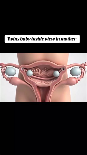 Understanding Twins: Inside View of Pregnancy