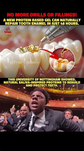 No more drills or fillings! #toothenamel #regenerategel #nottinghamuni #nofillings #proteingel