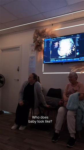 Baby in 4D 🫶🏻 on the big screen so everyone can see that gorgeous face. Did you have a 4D scan? Do you remember who baby looked like? #4dscan | Hey Baby 4D Barnsley