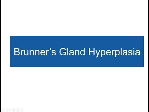 Brunner gland hyperplasia