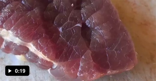 This is what muscle spasms look like. - Video