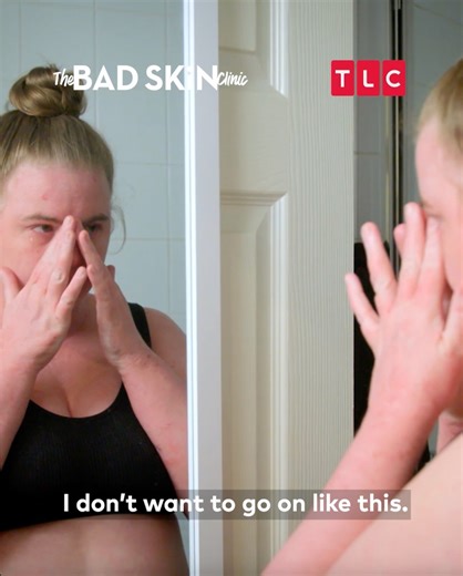 No skin problem is too complex for Dr Emma Craythorne and her team. Together they help to change lives for the better, one skin procedure at a time. 📺 The Bad Skin Clinic - Premieres 8 April, Mondays at 9:55PM (SEA) | 8:55PM (BKK/JKT) on TLC Southeast Asia | TLC Southeast Asia