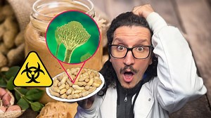 Aflatossine negli alimenti: cosa sono e quali danni possono causare