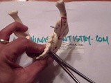 Mandible Fracture - Ivy Loop Fixation - Mandible Practice • Video • MEDtube.net
